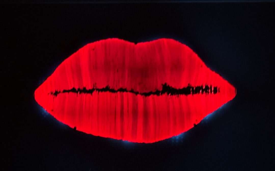 Kiss